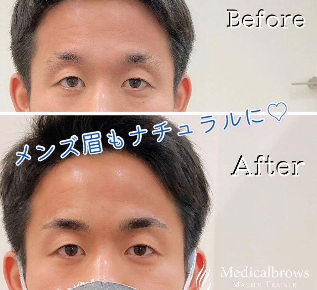 渋谷 アートメイクが受けられるクリニックおすすめ7選 眉毛 リップ アイラインなど Glamjp グラム