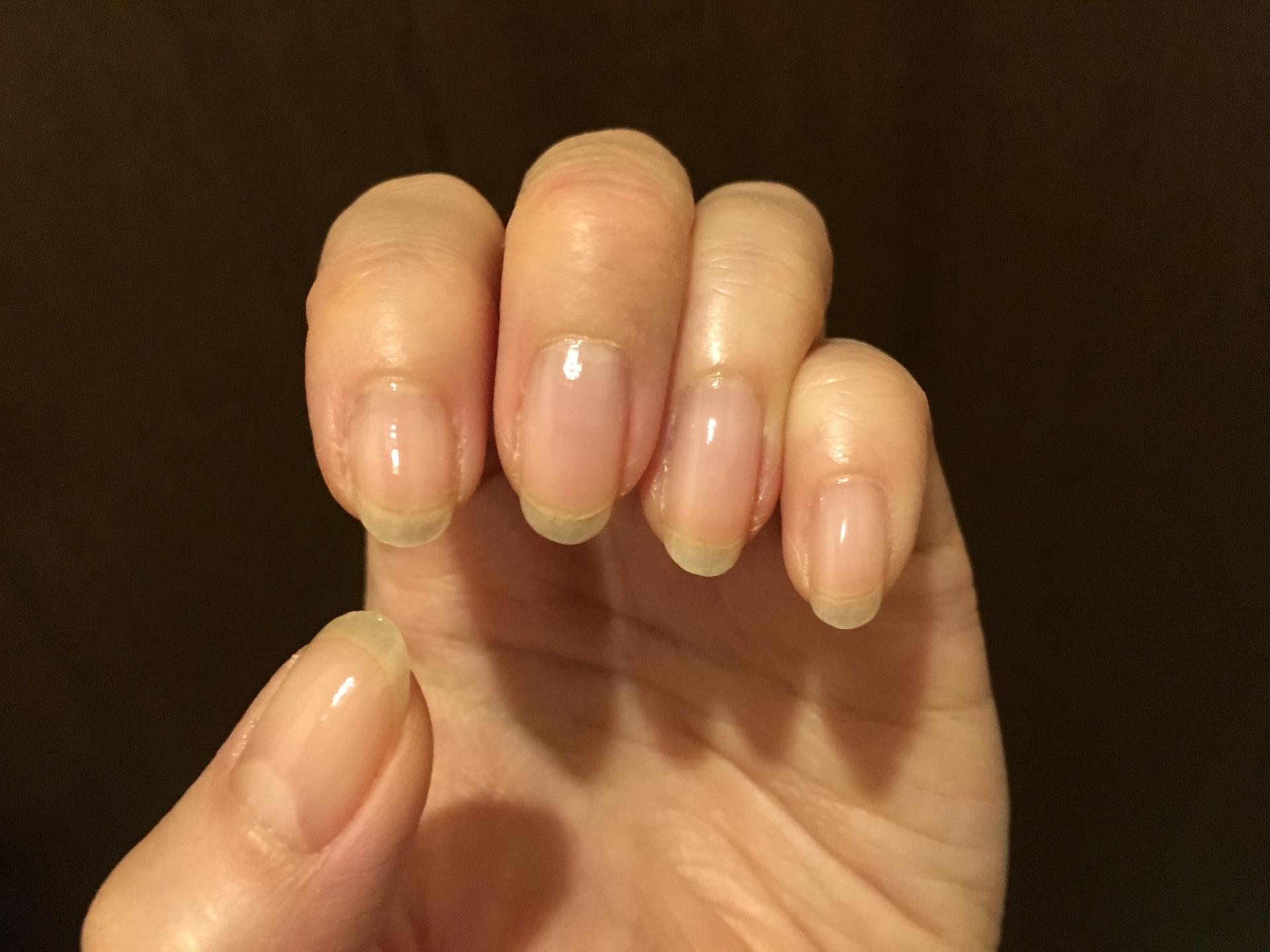 爪が伸びるのが早い理由とは？まず知っておきたい原因